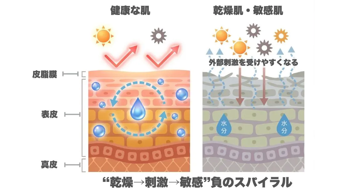 敏感肌のメカニズムのイラスト