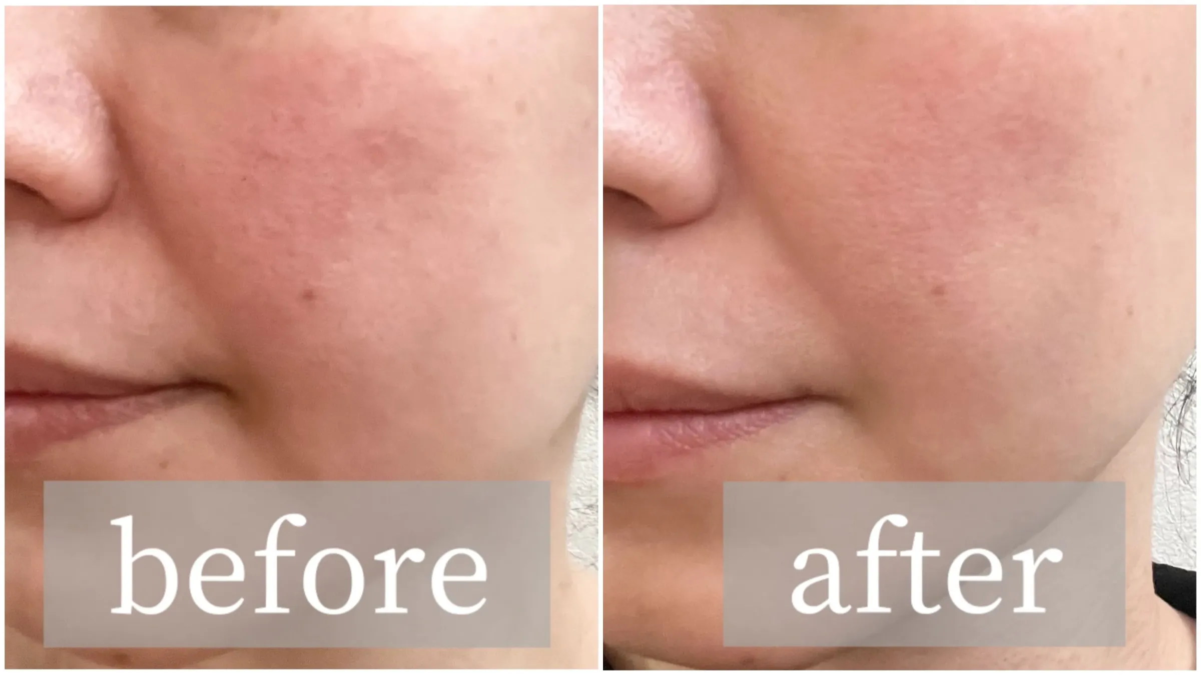 カレントボディLEDライトセラピーマスク