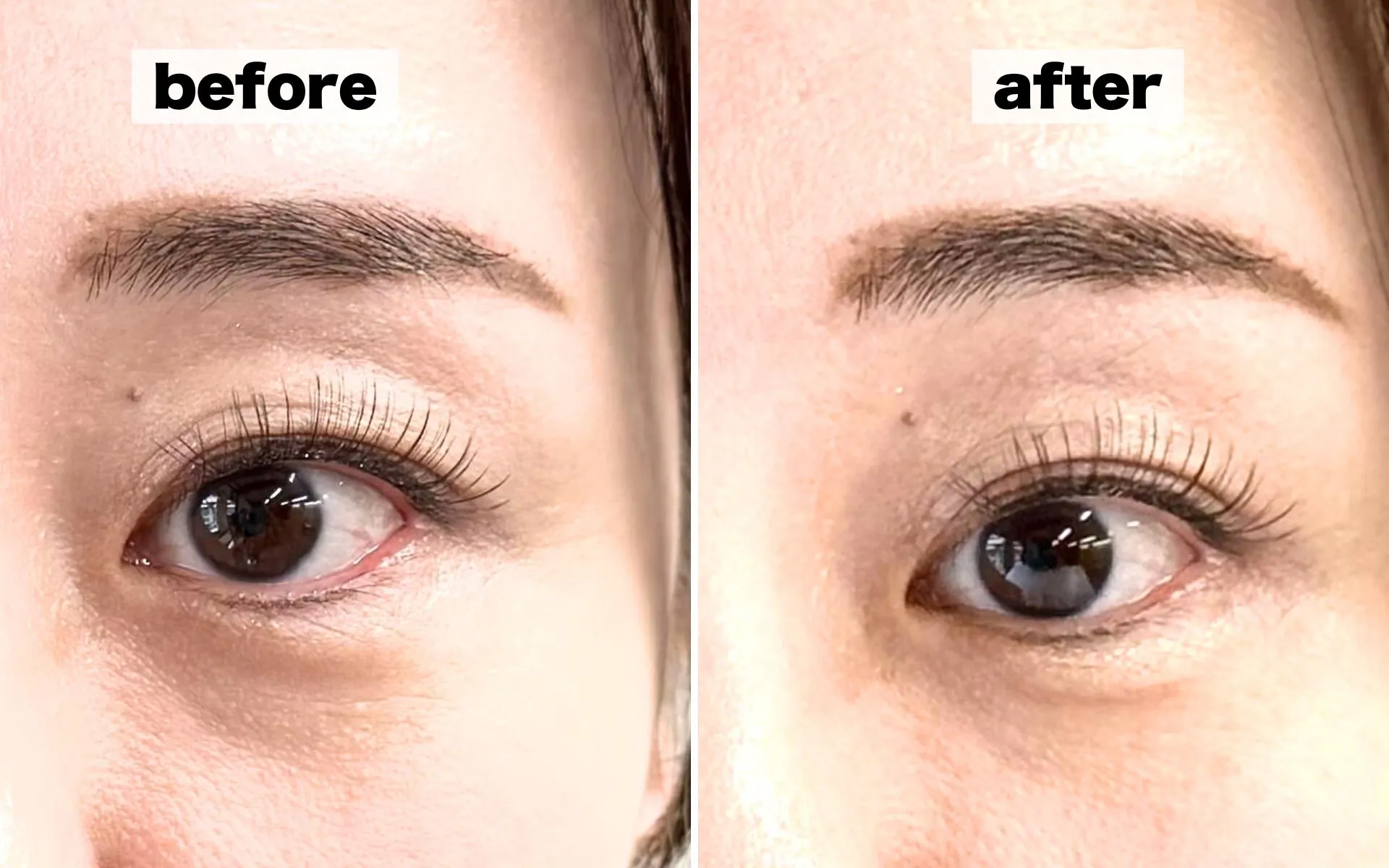beforeafter画像