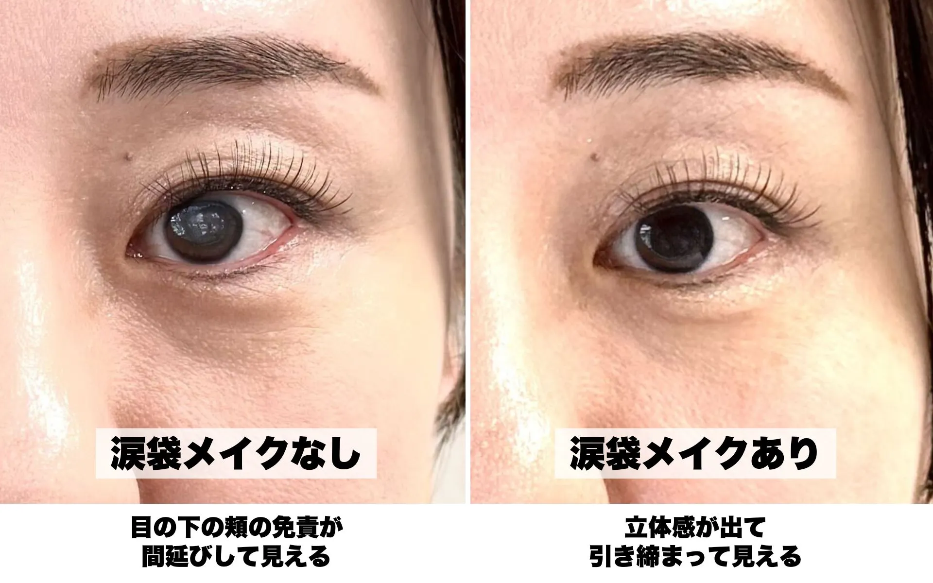 涙袋ライナーのbeforeafter画の比較画像