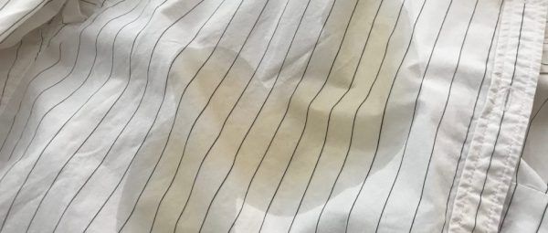 シミ取り