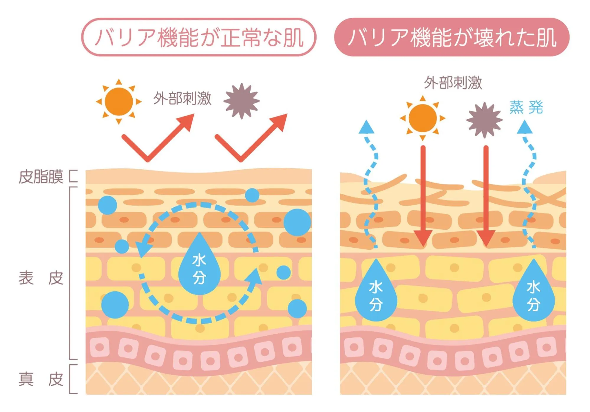 敏感肌の仕組み（イラスト）